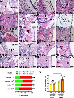 Trans-cortical vessels in the mouse temporal bulla bone are a means to recruit myeloid cells in chronic otitis media and limit peripheral leukogram changes